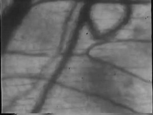 CapillaryBloodFlow.wmv