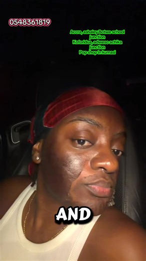 Effective Chemical Peeling for Dark Spot Removal in Accra