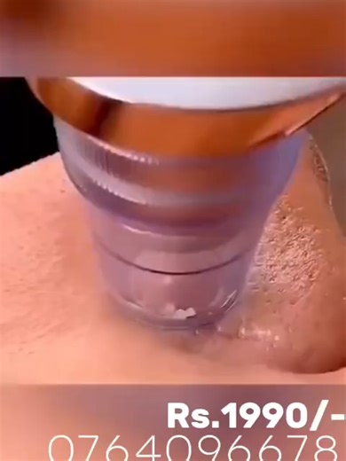 Cash On Delivery Face Vacuum – Limited Stock Rs.1990