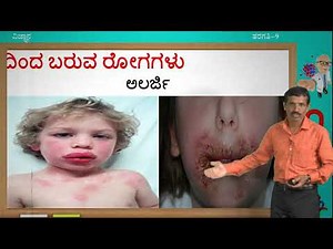 Samveda - 9th - Science - Naavu Eke Kaayile Beelutteve (Part 1 of 3) - Day 63