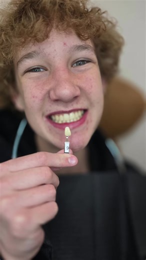 Smiling like it’s payday. Oh wait… it’s just a good day! #white #thehullaesthetic #teeth #foryoupage #foryou #whiteteeth #teethwhitening