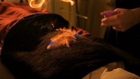 Chinese Fire Massage and Therapy Stock Video - Video of evening, burn: 113828401