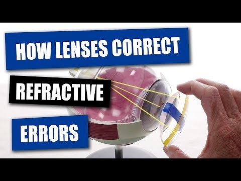 How Opticians Use Lenses To Correct Refractive Errors