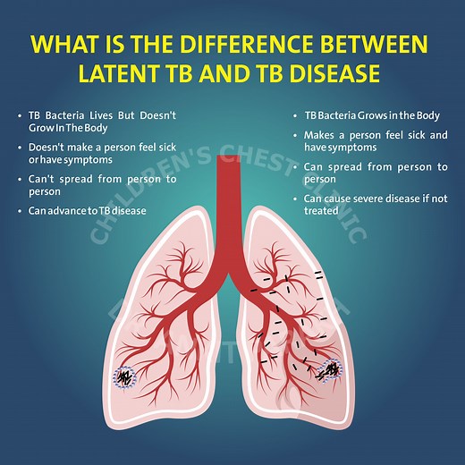 Latent Tuberculosis or Tuberculosis disease: What is the difference? - Dr. Ankit Parakh – India's best Pediatric Pulmonologist | Chest Specialist