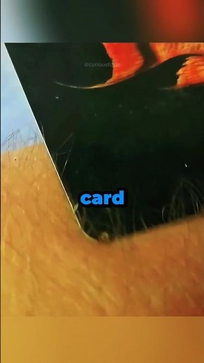 Bee Sting? Remove It Safely in Seconds with This Trick! 🐝