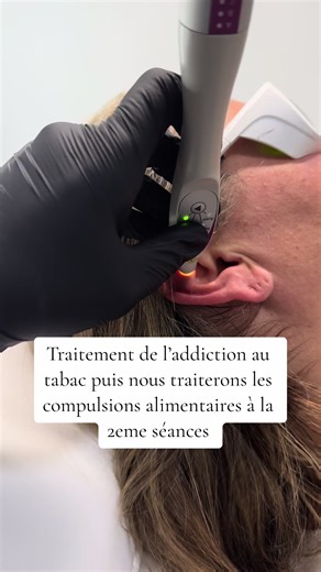 Arrêt du tabac avec laser et auriculothérapie - Matriochka Laser