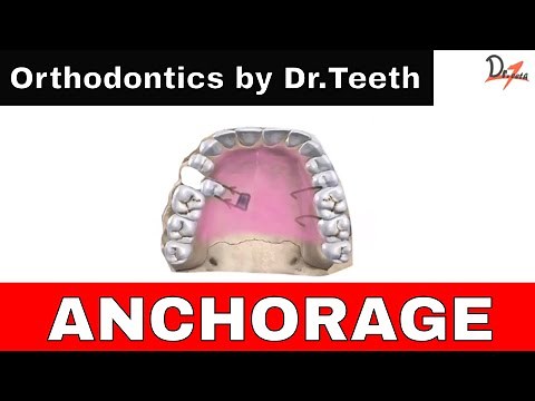 Anchorage in orthodontics | OVERVIEW |