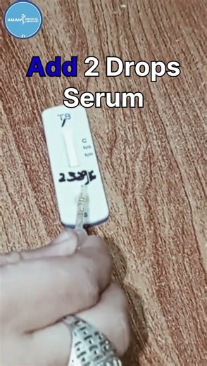 Tuberculosis Test Full Procedure #laboratory#trending #test #hematology #serology#oncology#unboxing