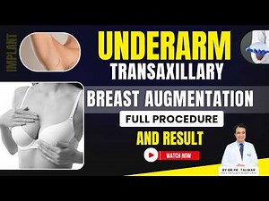 Underarm से Breast Implant Surgery कैसे होती है? | Transaxillary Technique Explained | Dr. PK Talwar