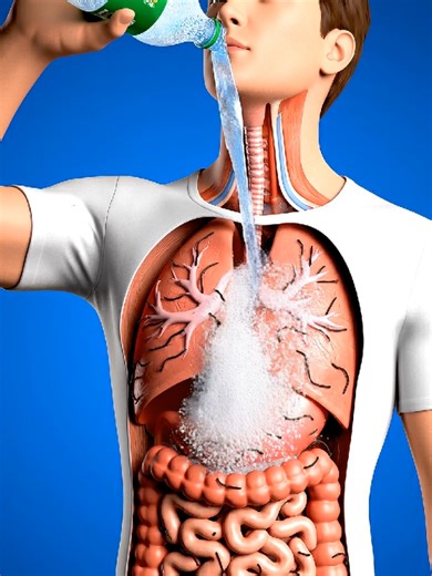 Looks Refreshing, Acts Aggressive – 7 Up Causes Stomach Chaos and Black Worms Reaction?#usa_tiktok #anatomy #health #foryoupage #digestivehealth