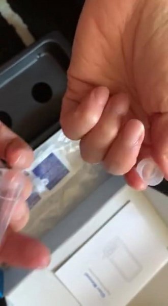 ScopeAround Digital Otoscope 