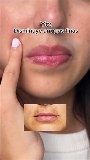 Es súper bueno para la hiperpigmentación! Inclúyelo a tu rutina diaria! 😊