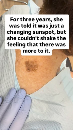 9.3K views · 203 reactions | This isn’t just a harmless brown spot —...