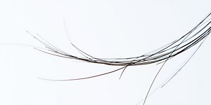 What's the Deal With These Weird, Long Dark Hairs on My Body?