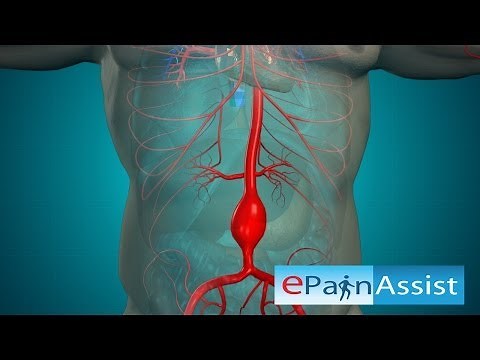 Open Abdominal Aortic Aneurysm and Endovascular Aneurysm Repair Surgery