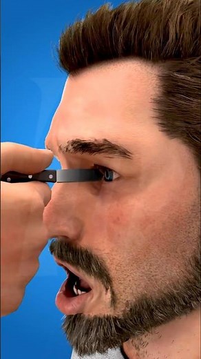 A Sharp Object in the Eye Is a Medical Emergency