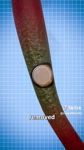 Why Button Batteries Are So Dangerous 😨 | Battery Charger