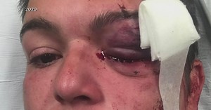 Injured journalist gives chunk of $600K settlement to Minneapolis community