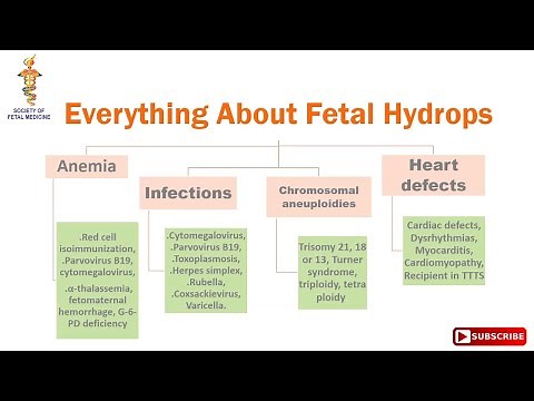 Everything About Fetal Hydrops