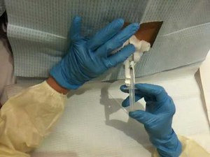 Intrathecal spinal tap