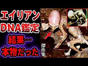 【総集編】エイリアンをCTスキャン、解剖、DNA鑑定した結果…ヤバい事実が判明…眠れないほど面白い宇宙人にまつわる都市伝説【ゆっくり解説】【UMA•未確認生物】