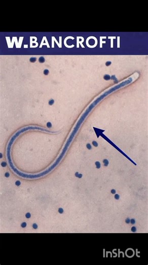 Parasites Living in Your Blood 😱#parasite#medicaleducation#laboratory #Medical short