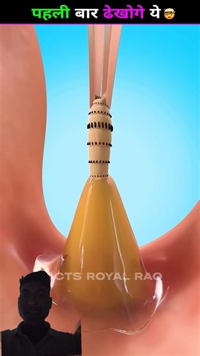 jab aap ko machar kaat le tab aap kya karoge #biswapatisarkar #hardiljopyarkarega #hardikpatel