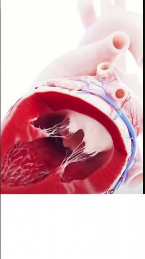 Heart Valve Surgery Explained in 3D Animation - Easy to Understand