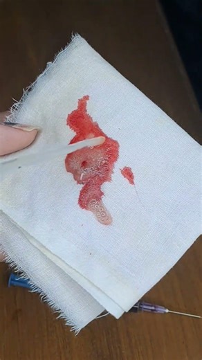 How to remove blood stain?#generalchemistry #experiment #sciencepassion #sciencefacts #viralvideo