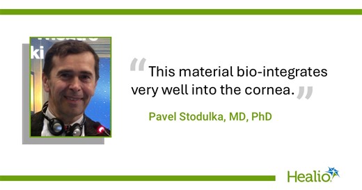 Corneal microlens for presbyopia easy to explant when cataract surgery is needed