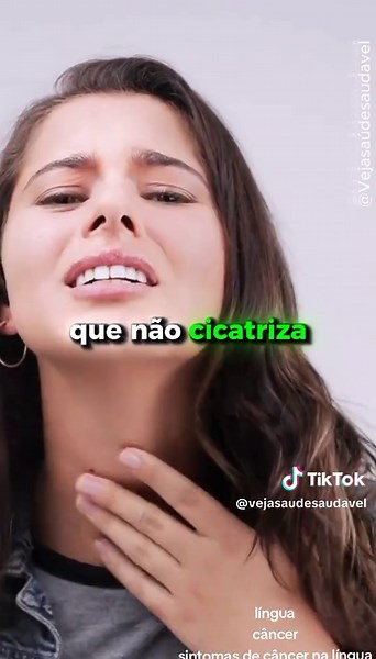 Sinais de Câncer na Língua: O Que Você Precisa Saber