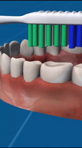 The Truth Behind Toothpaste Stripes Explained