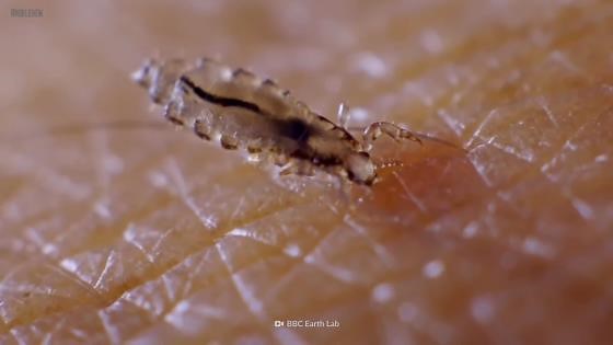 Das Schlimmste, was du bei Läusen tun kannst