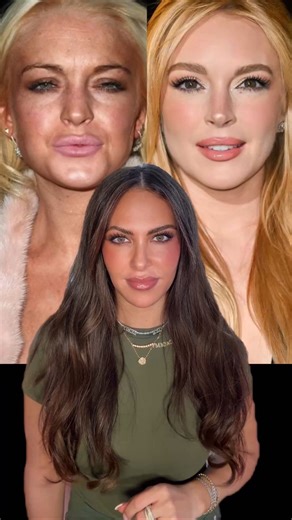 We explore how Lindsay Lohan’s transformation proves it’s never too late to make a comeback. Her recent look shows a more sculpted, refined version of herself, slimmer, naturally contoured, and balanced. Her lips and cheeks have subtle volume that enhances her signature features, not changes them. Even with likely surgical refinements, she remains authentically Lindsay! A reminder that the best transformations highlight who you are, not hide it 🤍 #TheKagaAcademy | The Kaga Academy