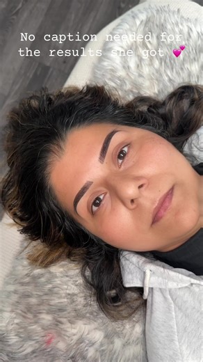 Stunning Microblading Results in Surrey