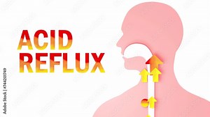 3d animation of esophagus with gastric reflux and heartburn. With arrows, circles and the word "acid reflux" of fire. Digestive system and human silhouette on white background.