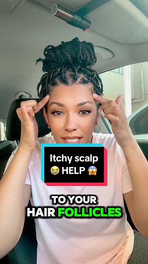Understanding Itchy Scalp Issues with Braids