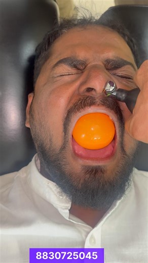 CFR for Facial Pain #chiropractor ##reelsvideo #reelsviral #migraine #virals #trending#Nashik#Pune##