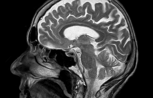 10 Recent Neuromarketing Research Studies with Real-World-Examples