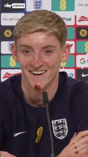 Gordon went '10ft in the air' during bike crash