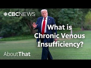 What we know about the state of Trump’s health | About That