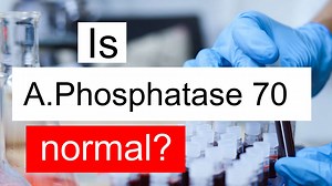 Is Alkaline phosphatase 70 normal, high or low? What does ALP level 70 mean?