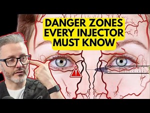 The Most Dangerous Injection Zones in the Face, And the Anatomy You MUST Know to Avoid Them