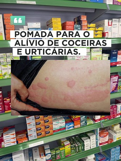 Pomada para Alívio de Coceiras e Urticárias em Portugal