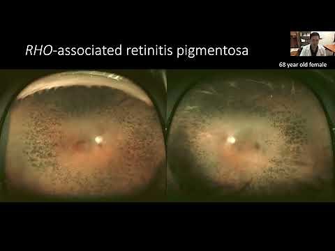 Lecture: The Clinical Examination & Management of Inherited Retinal Diseases