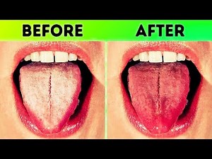 12 GREAT TIPS FOR HEALTHY TEETH
