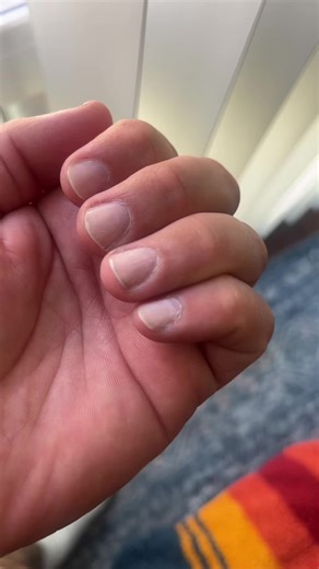 As a gay man and also as a man we should also be taking care of ourselves #cleanup #healthynails #manicure #practice #man