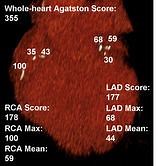 Lesion specific calcium score - Alchetron, the free social encyclopedia