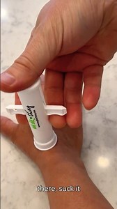 🦟 The Bug Bite Thing Review: Does It Really Work? #amazonfinds #summer #outdoors