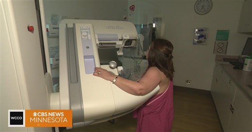 What you need to know about early breast cancer detection